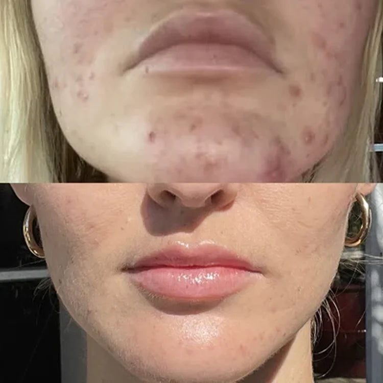 Cell Renewal available online from Mia Bella Aesthetics in Middletown, DE