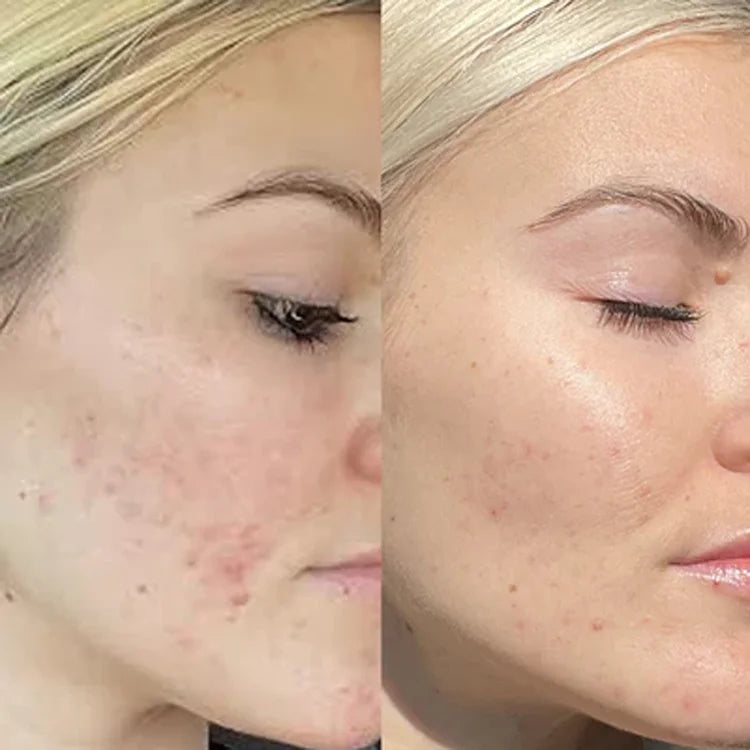 Cell Renewal available online from Mia Bella Aesthetics in Middletown, DE