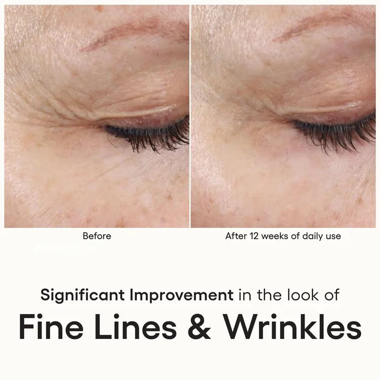 Plated- Intense available online from Mia Bella Aesthetics in Middletown, DE