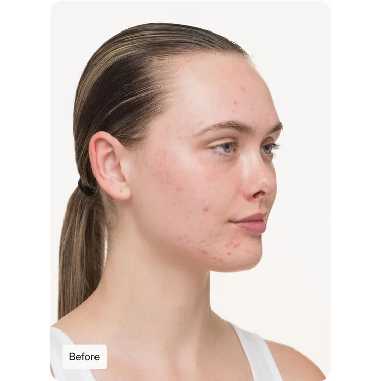 Nutrafol Clear Skin available online from Mia Bella Aesthetics in Middletown, DE