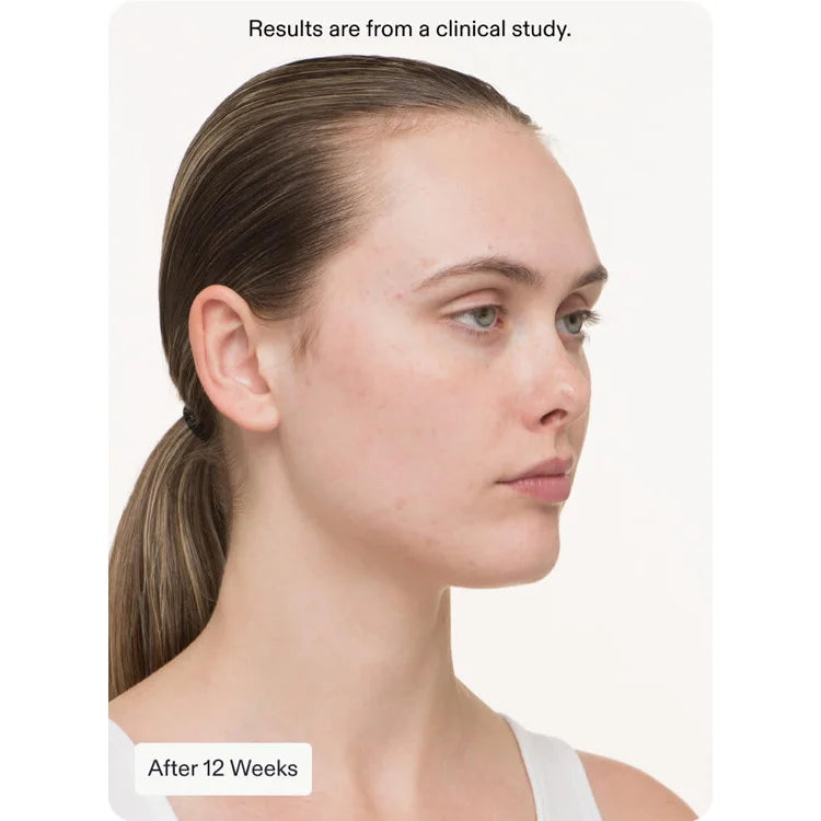 Nutrafol Clear Skin available online from Mia Bella Aesthetics in Middletown, DE